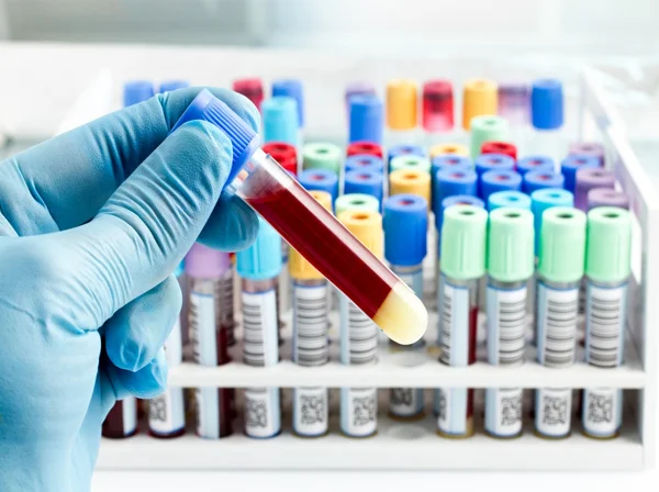 Lab Test